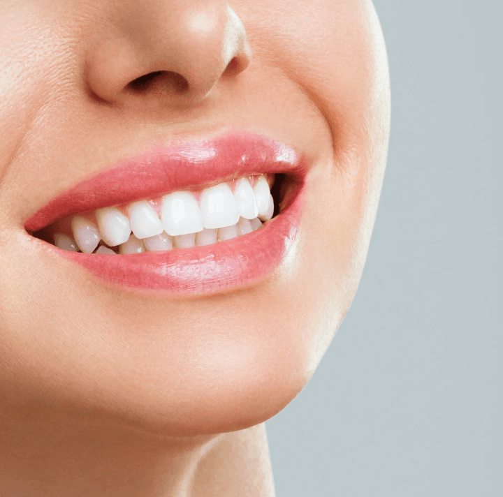 Dental Bonding Portland | Fix Chipped Teeth | Advanced Dental Arts NW